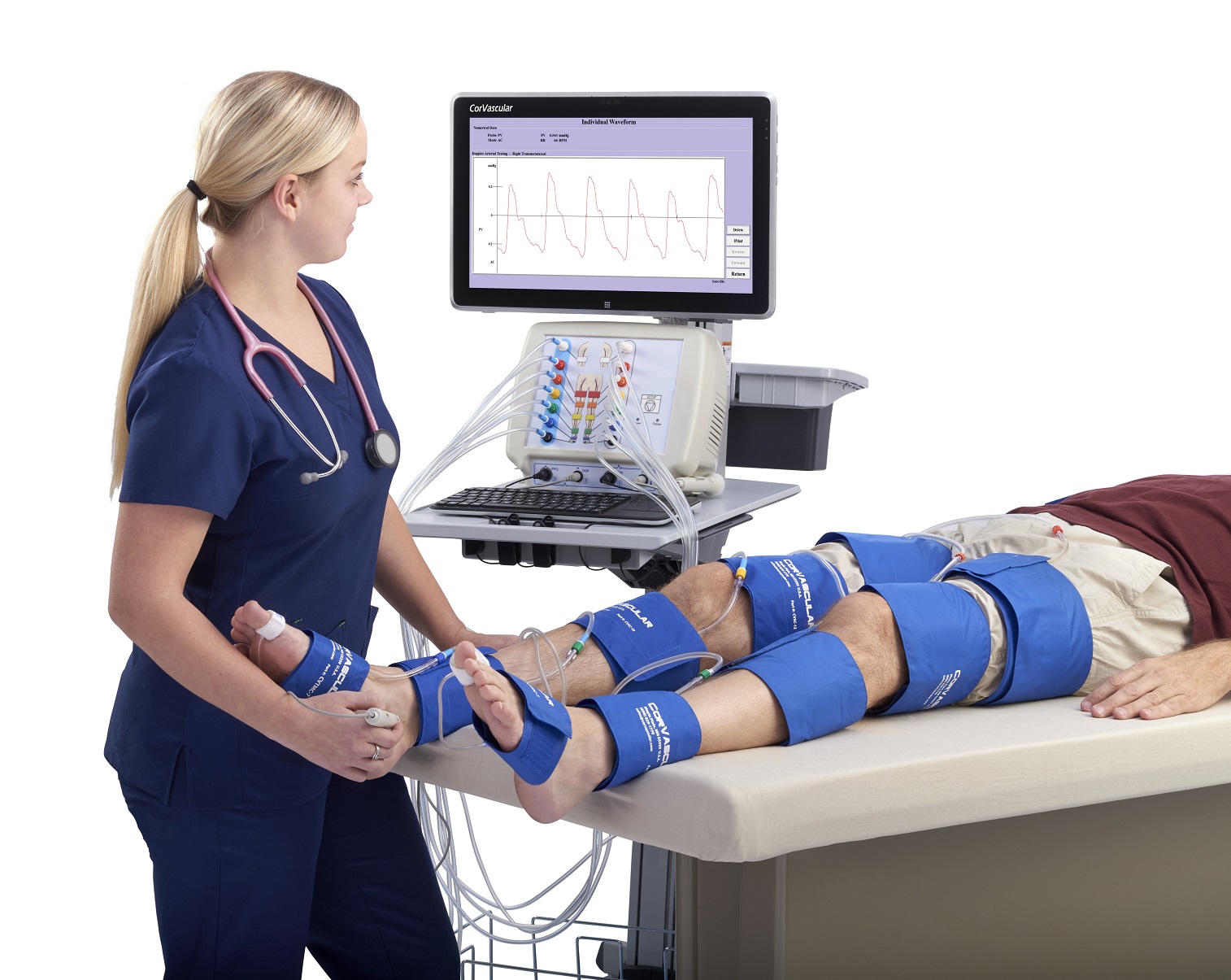 VasoGuard F14 System Overview